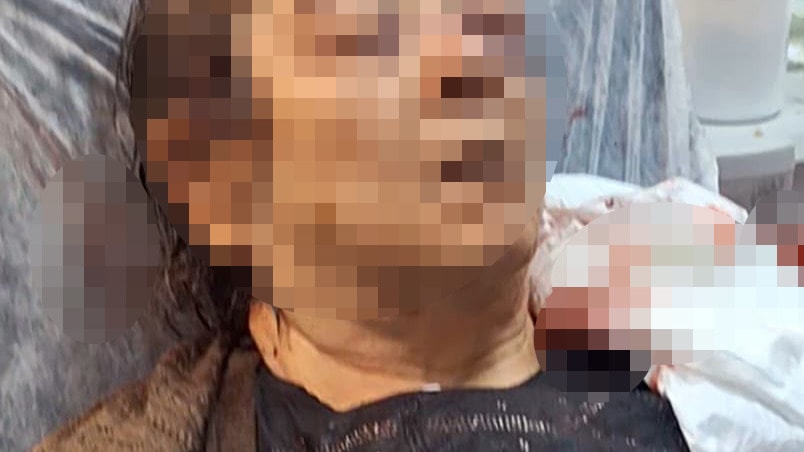 Kayseri'de 75 yaşındaki kadın, tavandan kopan moloz altında yaralandı