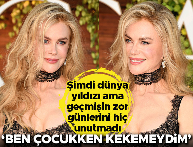 Kekemelikten Yıldızlığa: Ünlü Aktörün İlham Veren Hikayesi