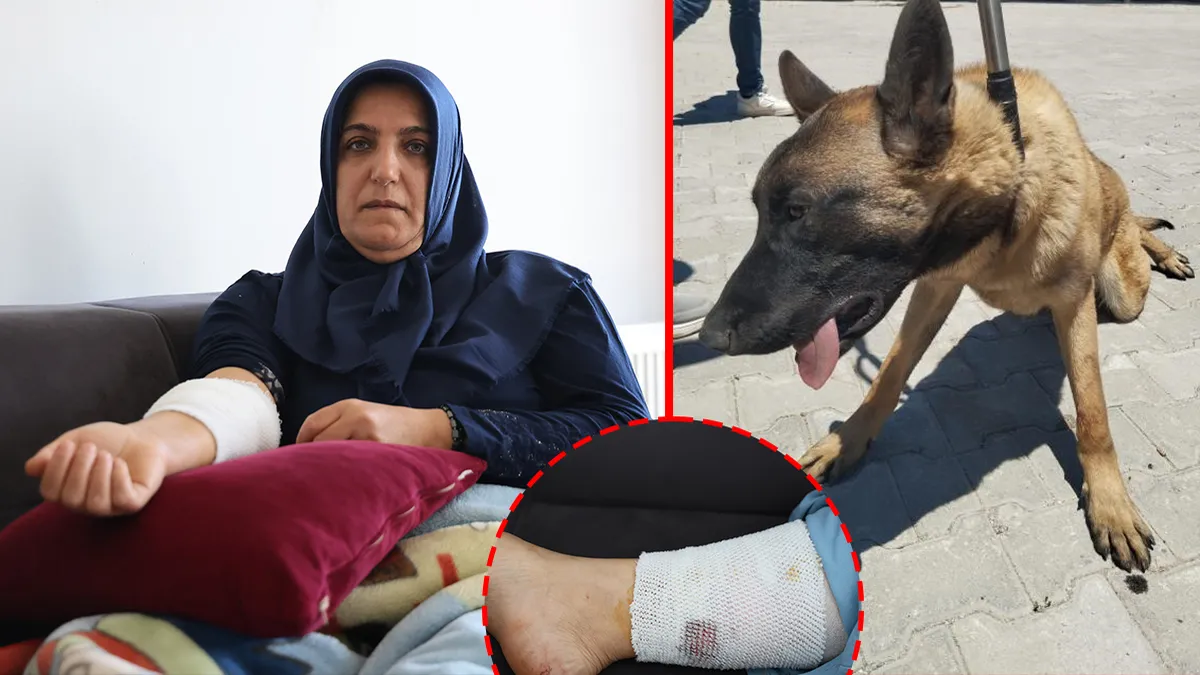Kızını yolcu etmek isterken başıboş köpek saldırısına uğradı: Beni paramparça edecekti