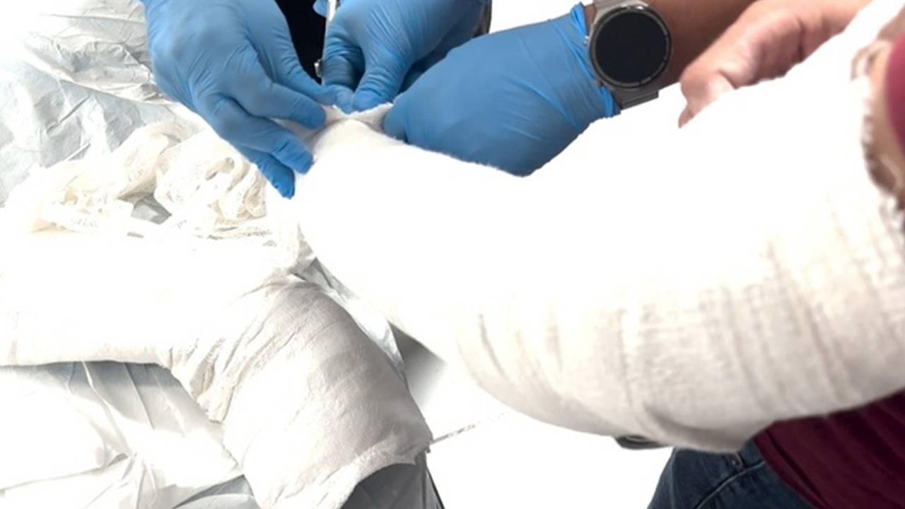 Kolundaki Alçıda 1 Kilo Metamfetaminle Yakalandı, Tutuklandı