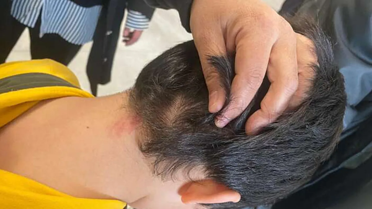 Konya'da ilkokulda veli dayak skandalı: Fırça sapına 'silah' kararı