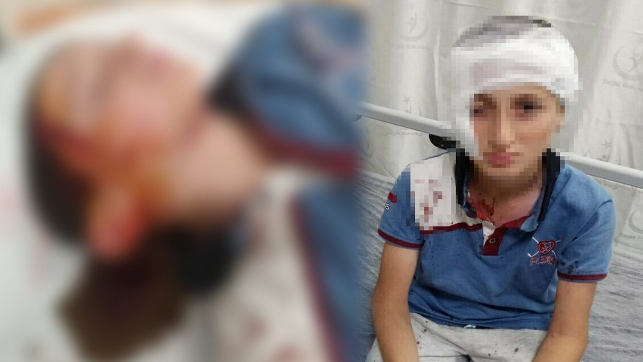 Köpek Saldırısında 11 Yaşındaki Çocuğa 1,2 Milyon TL Tazminat