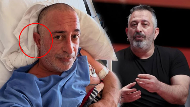 Kulak Memesi Çizgisi Kalp Krizi Riskini mi Gösteriyor