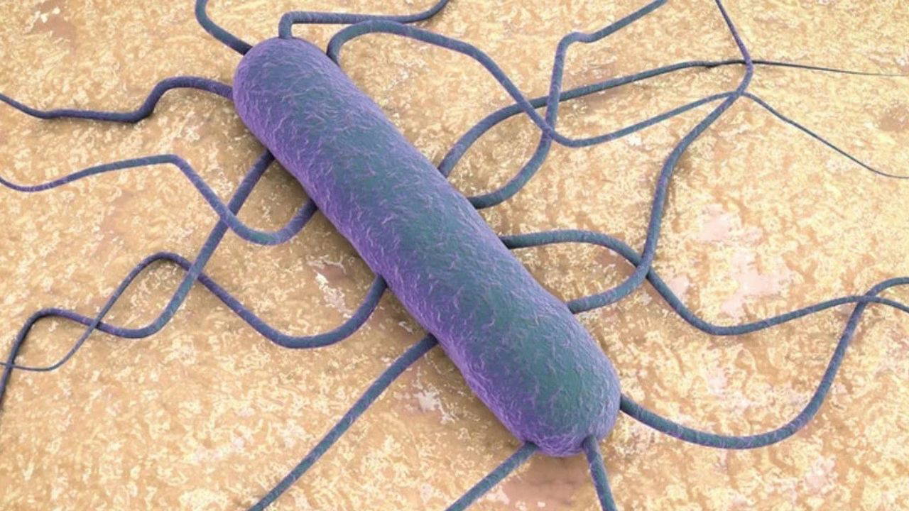 Listeria bakterisi nedir? Tahsildaroğlu peynirinde alarm