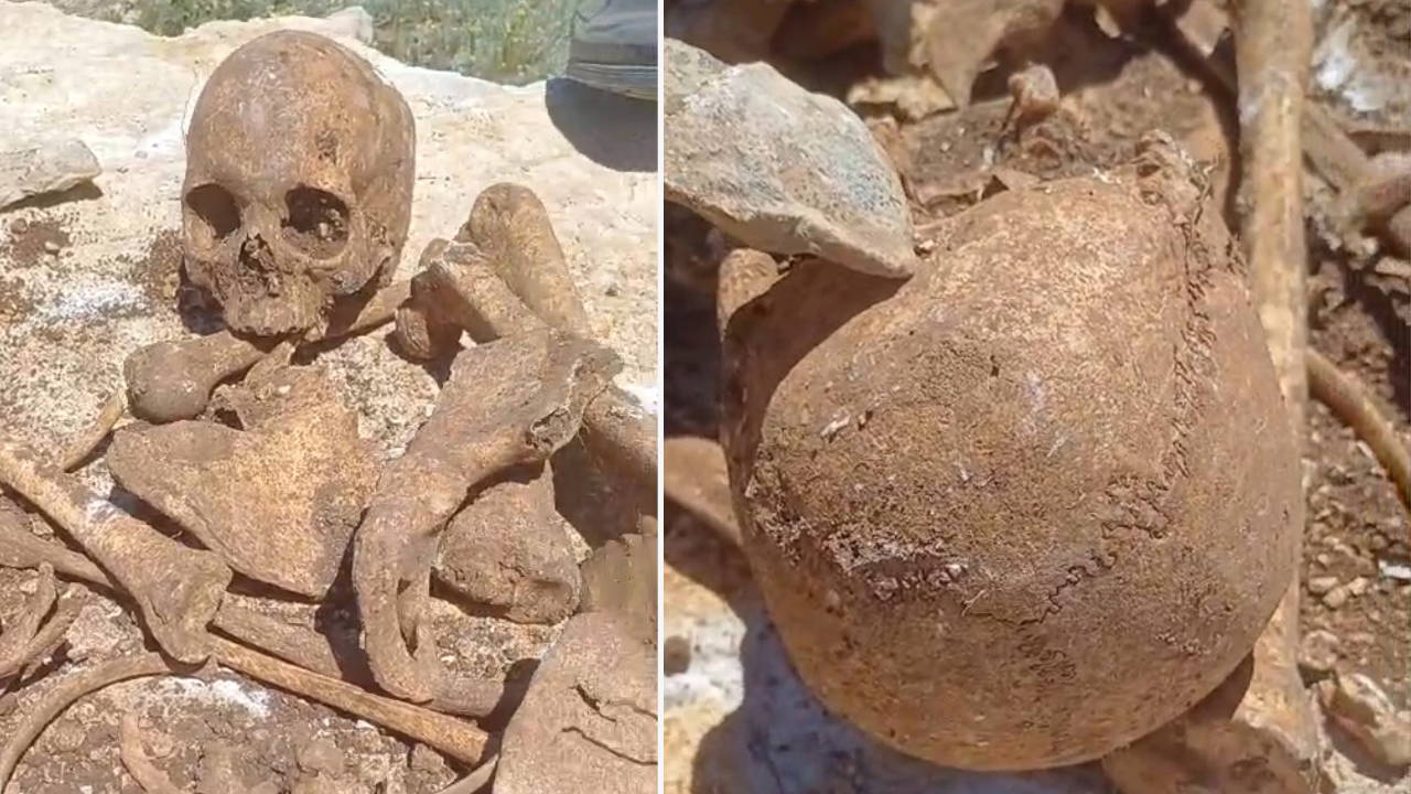 Malatya'da inşaat kazısında insan kemikleri bulundu