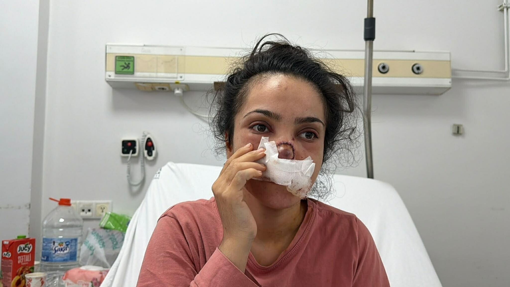 Manisa'da yamyamlık dehşeti: Isırılarak burnu koparılan kadın o anları anlattı