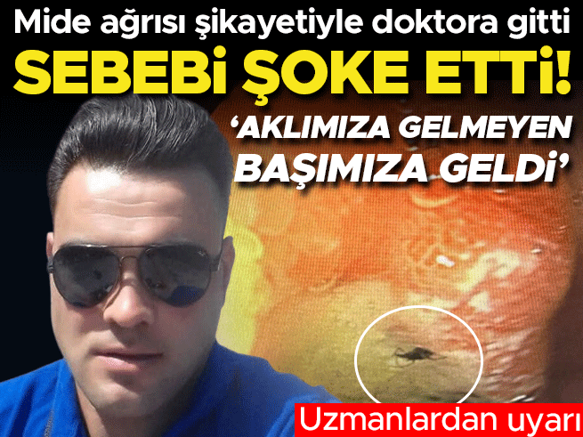 Mide ağrısı şikayetiyle doktora gitti, karnından böcek çıktı