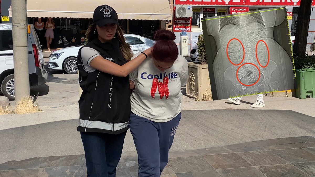 Midesinden 70 Parça Uyuşturucu Çıktı, Hemen Gözaltına Alındı