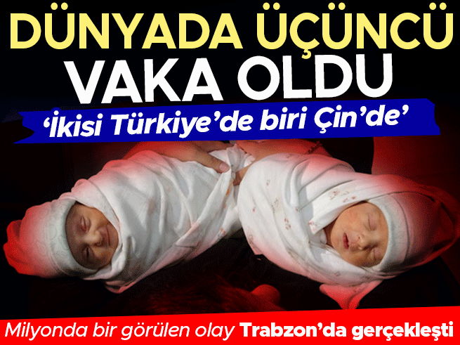 Milyonda Bir Görülen Olay: Trabzon'da Çifte Rahimde İkiz Bebek Dünyaya Geldi