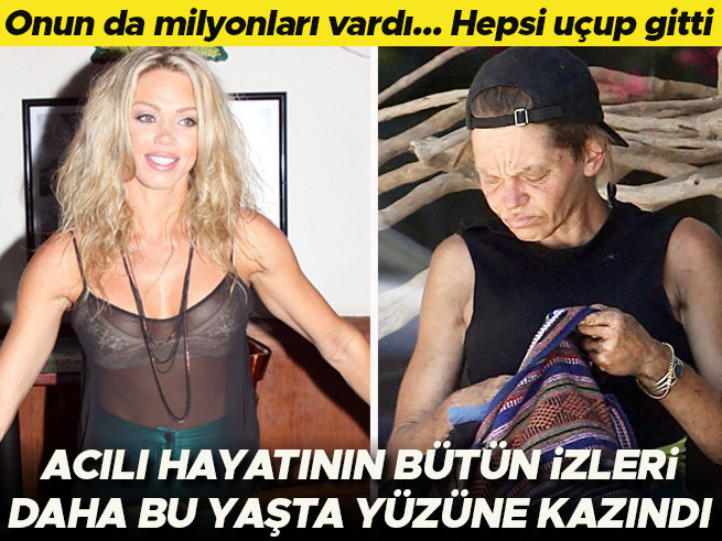 Milyonları vardı, hepsi uçup gitti! Henüz çocuk yaşta acının izleri yüzüne kazındı