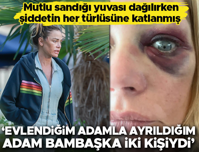 Mutlulukla Kurduğu Yuvayı Eşinden Şiddet Gördüğü İçin Yıkmak Zorunda Kaldı: 'Evlendiğim Adamla Ayrıldığım Adam Bambaşka İki Kişiydi