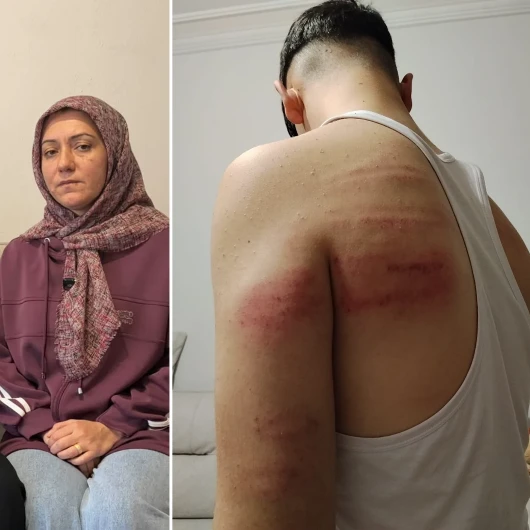 Niğde'de İki Berber Çırağına İşkence İddiası: İş Yeri Sahibi Serbest