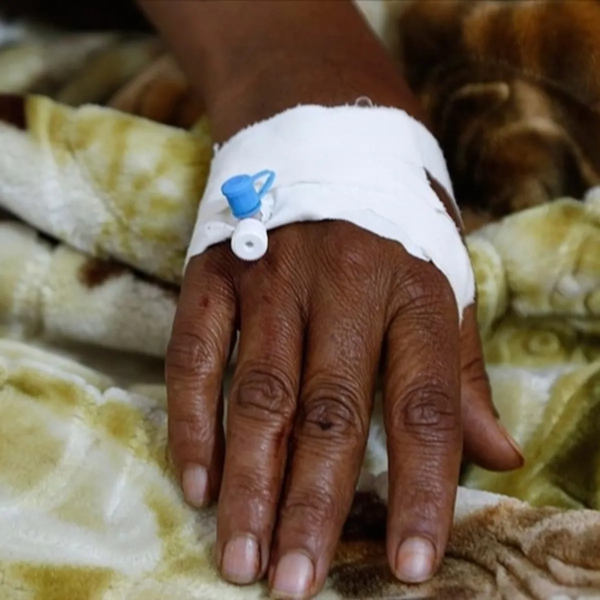 Nijerya'da Kolera Salgını: 27 Can Kaybı