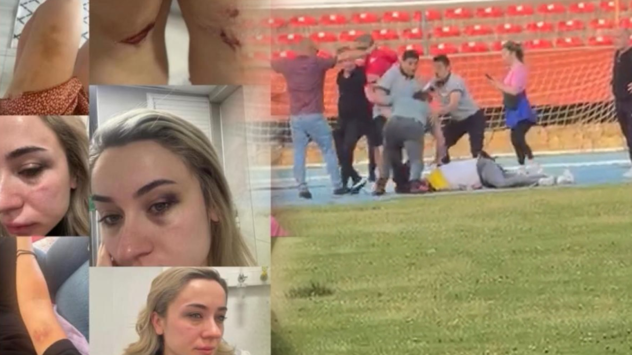 Öğretmen Elif eski eşinin şiddetini sosyal medyada ifşa etti