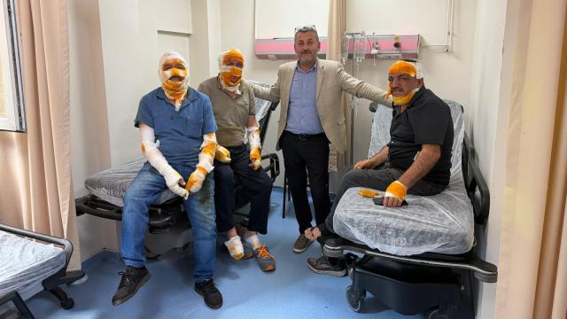 Ordu Mesudiye'de Mutfak Patlaması: 5 Yaralı