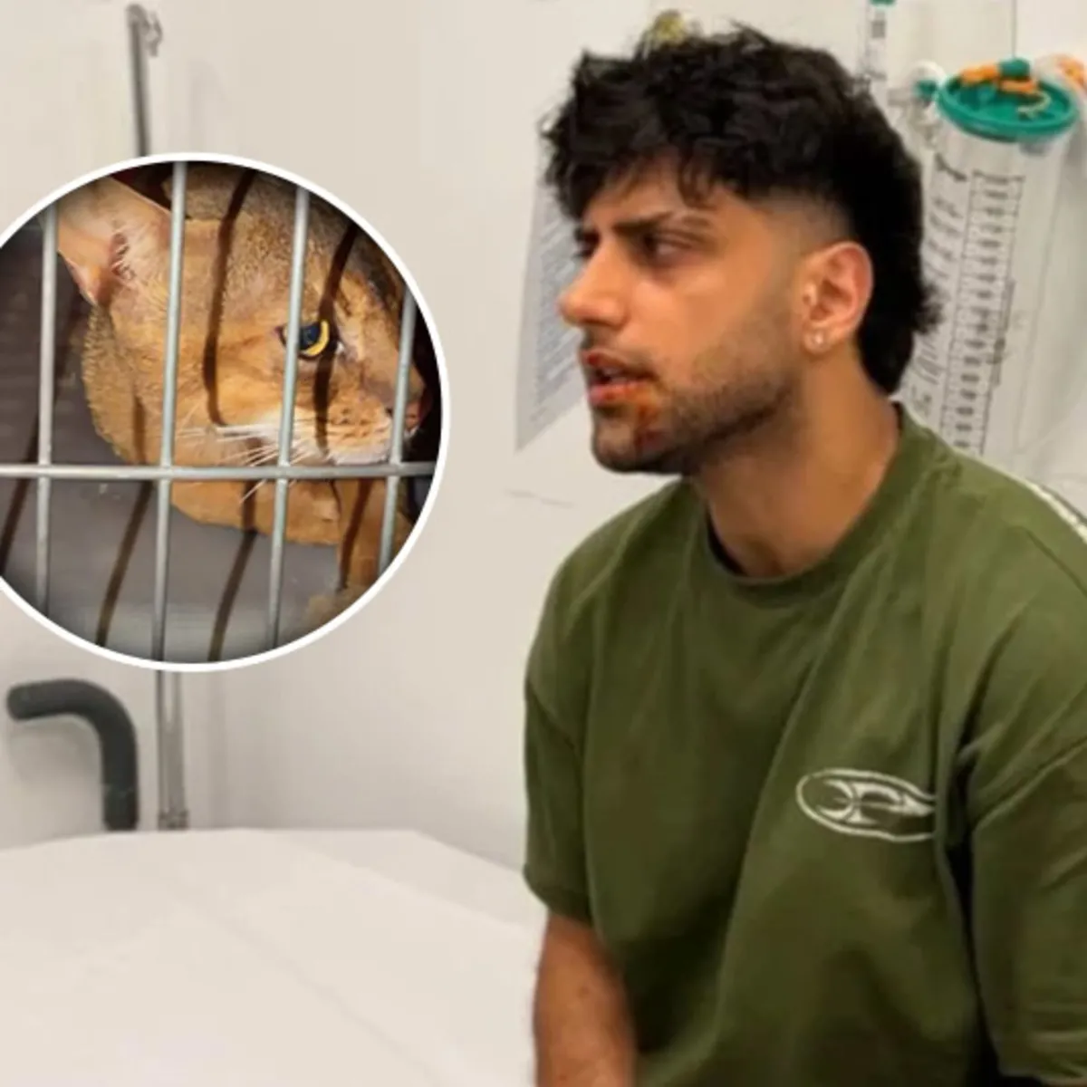 Reynmen’i evde beslediği kedi saldırdı: ‘Gece gece nasıl dövdü’