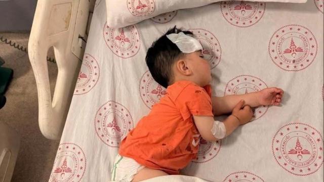 Şanlıurfa'da köpek saldırısı: Mülkiye müfettişi görevlendirildi
