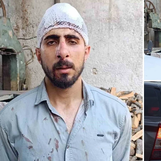 Şanlıurfa'da Trafikte Yavaş Giden Sürücüye Dayak: Burnu Kırıldı, 8 Dikiş Atıldı
