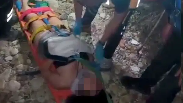 Saros'ta Kayalıklardan Düşen Genç Kız Yaralandı