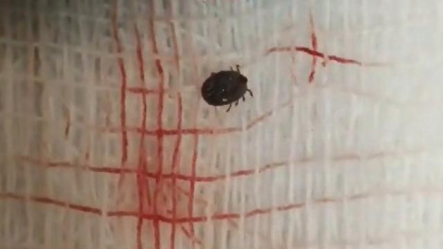 Sivas'ta Kene Isırması Sonucu Bir Kişi Daha Hayatını Kaybetti