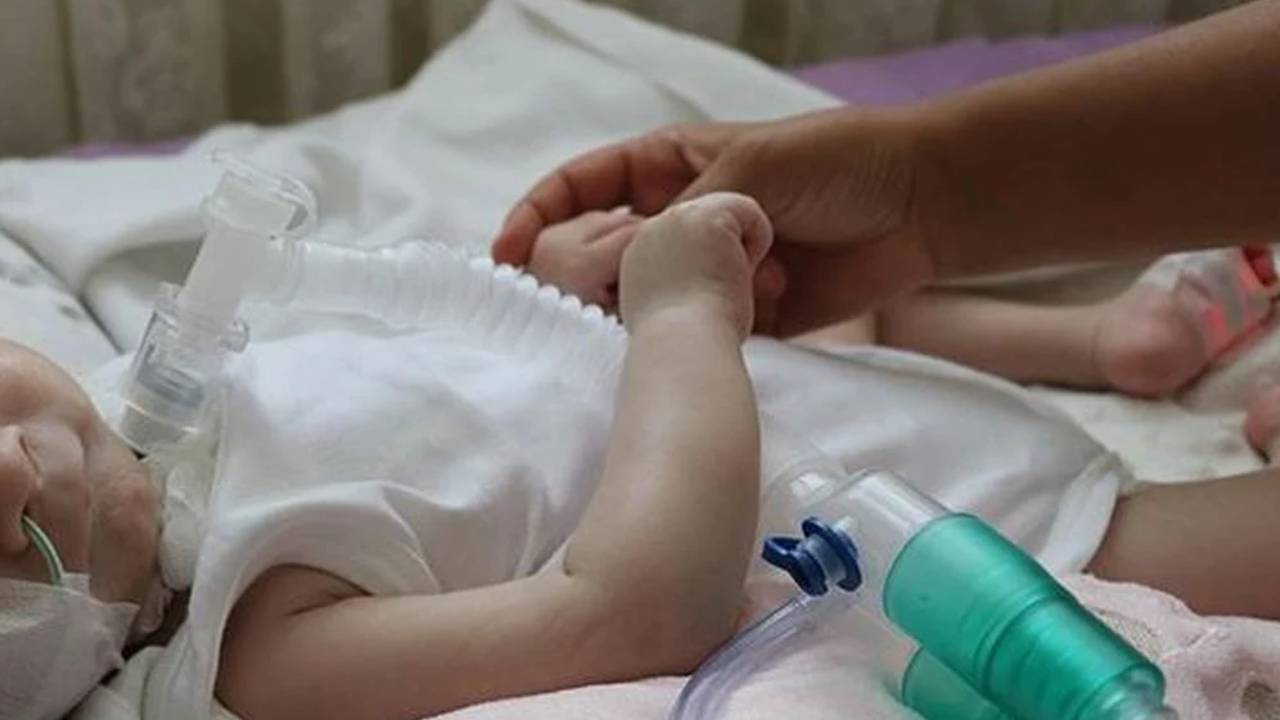 SMA tedavisinde asıl mücadele sistemin güçlendirilmesi