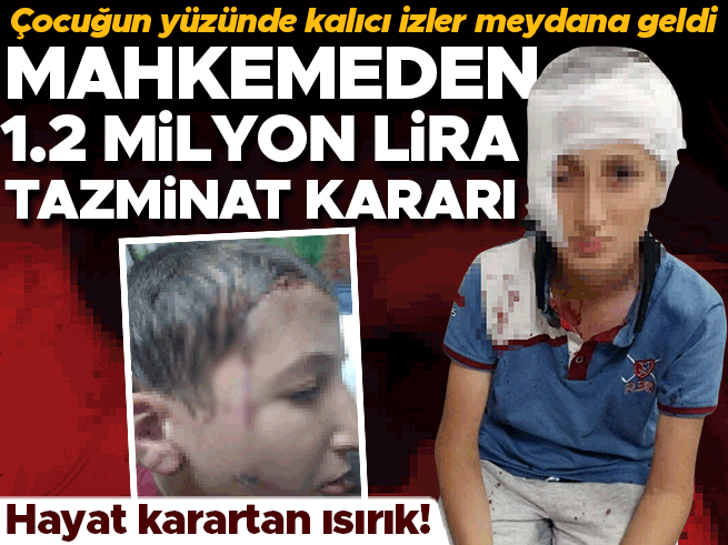 Sokakta Köpek Saldırısına Uğrayan Çocuğun Ailesine 1,2 Milyon TL Tazminat