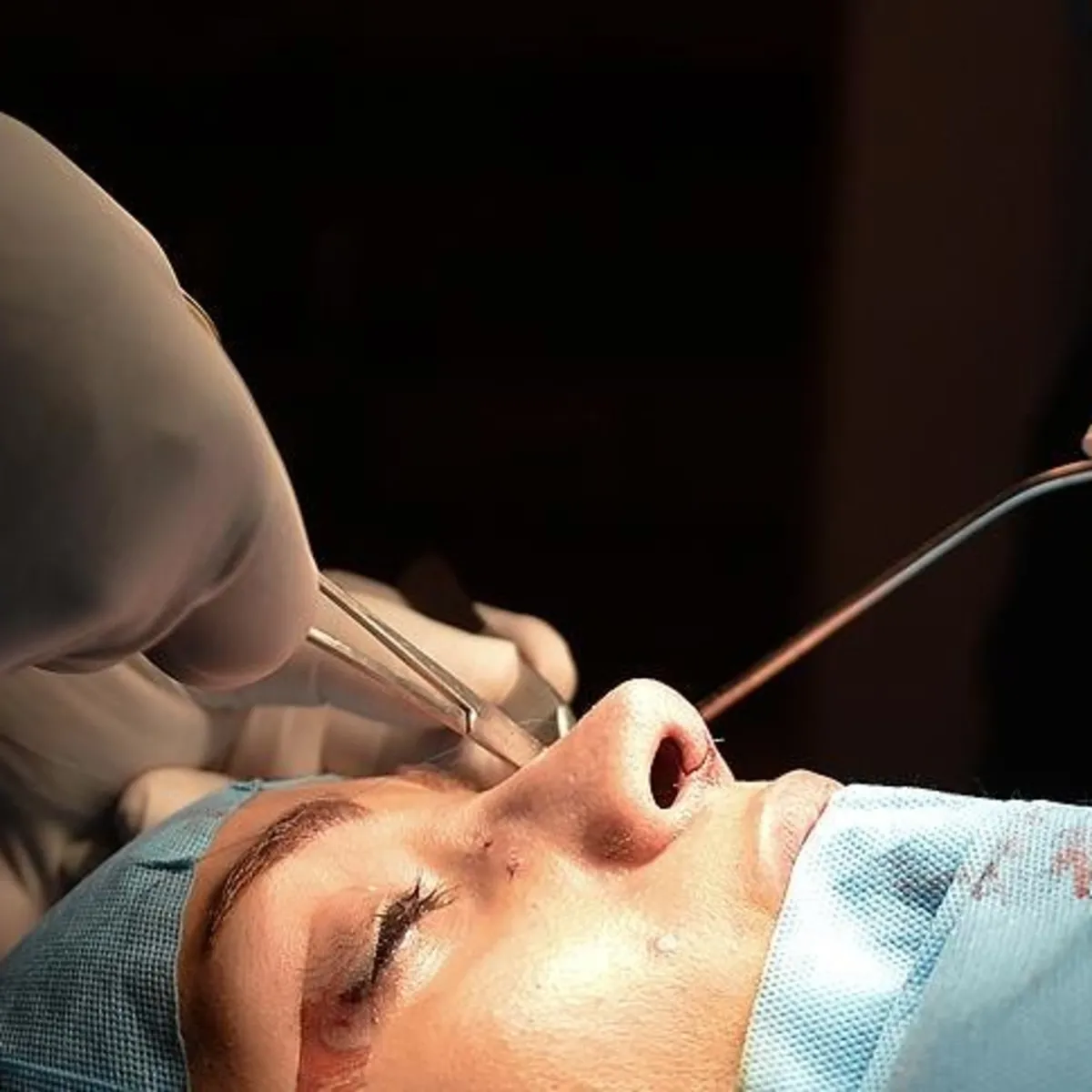 Sosyal medyanın estetik baskısı: Yaş sınırı 13'e düştü
