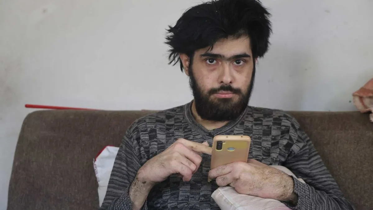Telefon Bağımlısı Barış Özbay Tedaviyi Reddetti: 3 Yıl Evden Çıkmadı