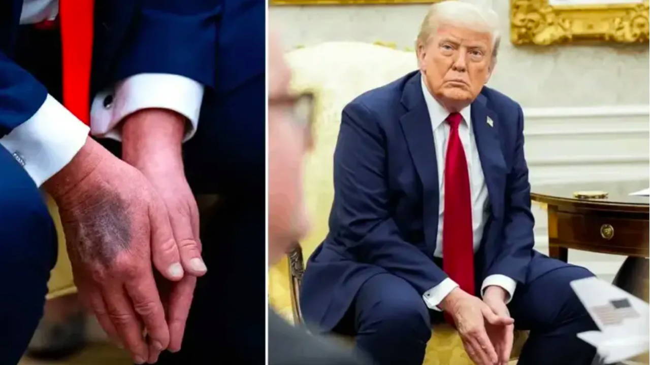 Trump'ın sağlık raporu açıklandı: Göreve uygun