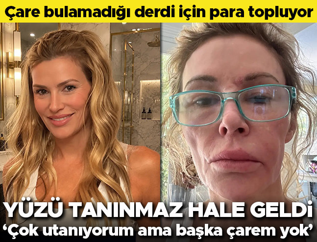 Ünlü Oyuncu Hastalık Tedavisi İçin Yardım Kampanyası Başlattı: 'Çok Utanıyorum