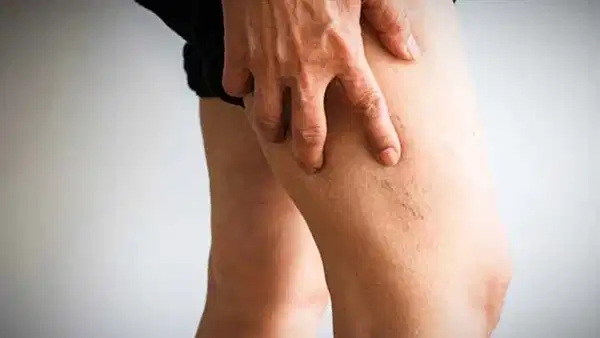 Uzun Yolculuklarda Pıhtı Riskine Dikkat: Her 1-2 Saatte Bir Kalkın