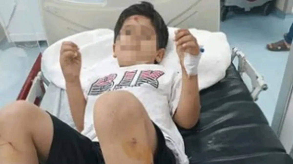 Viranşehir'de sahipsiz köpek saldırısı: Bakanlık müfettiş görevlendirdi