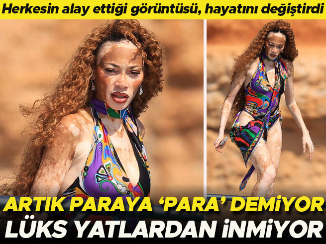 Vücut Kompleksleri Onu Milyoner Yaptı: Lüks Yatlar Onun Hayatı Oldu