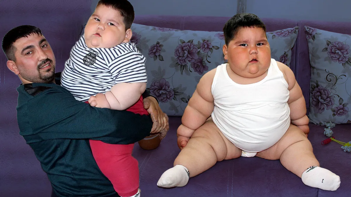 Yağız'ın inanılmaz değişimi! 5 yaşında 90 kiloydu: Son hali görenleri şaşırttı