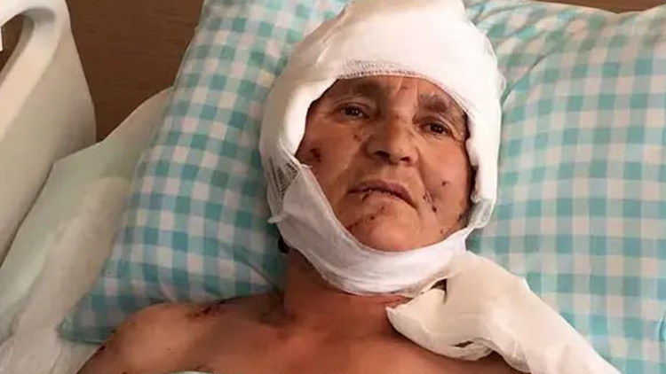 Yargıtay'dan emsal karar: Köpek saldırısında malul kalan kadına 637 bin lira tazminat
