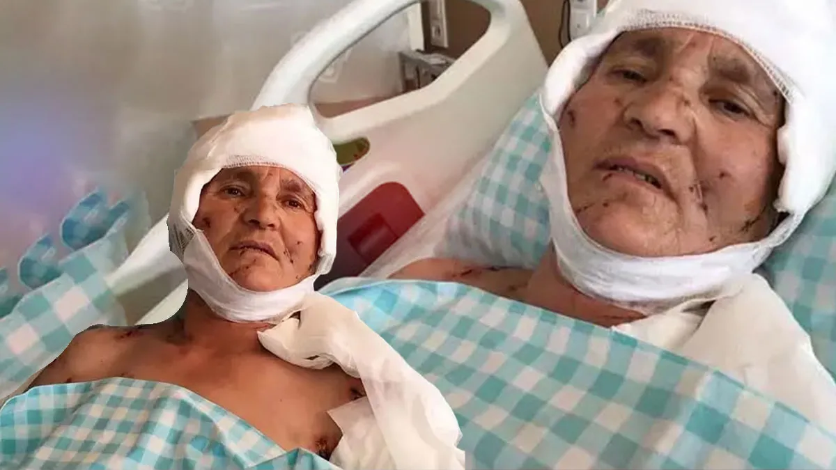Yargıtay'dan Emsal Karar: Köpek Saldırısı Mağduru Yaşlı Kadına Tazminat Onandı